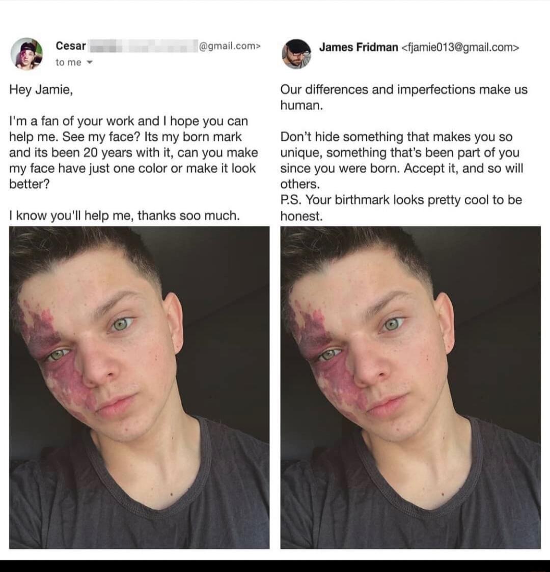 Vs Yol Hoy Jamie afan of your work and hope you can help me See my face lts my born mark and it Boen 20 years wth can you make my face have just one colr or make tlook bette 1know youl help me thanks so0 much e dunasmpacats Our difeences and imperfections make us human Donit ide something that makes you so unique something thats been part of you since you were bom Accept t and so will others PS Yo