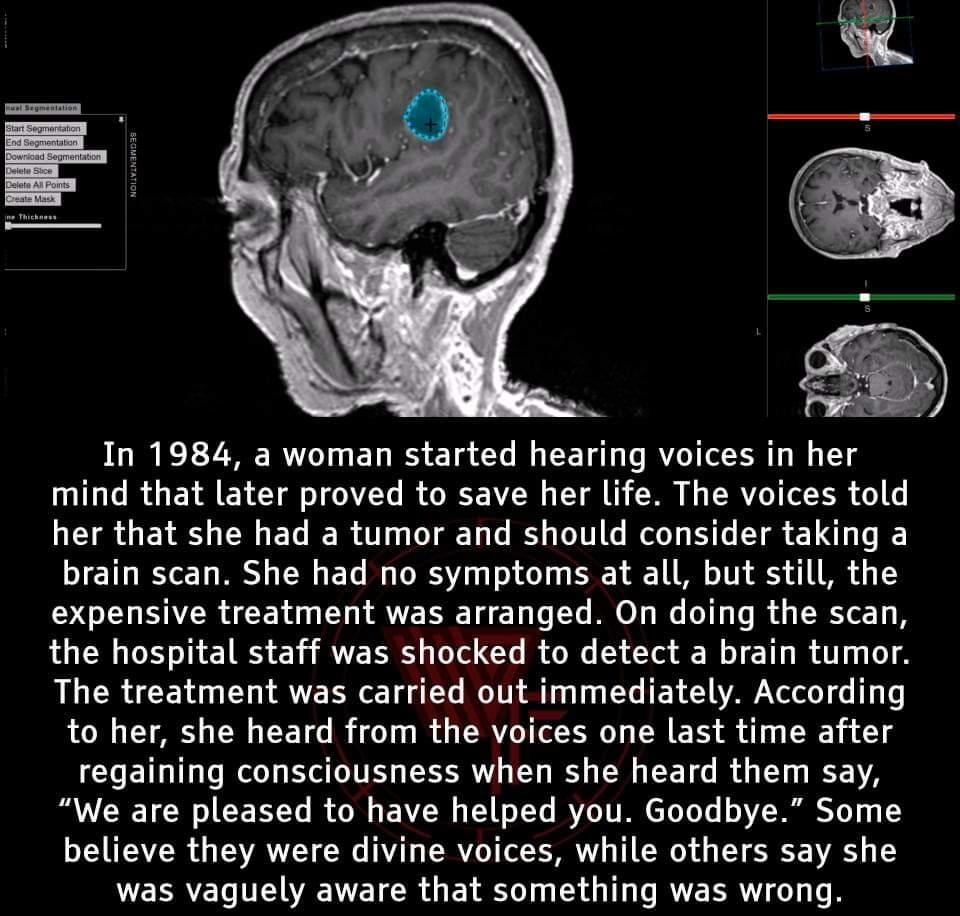 In 1984 a woman started hearing voices in her mind that later proved to save her life The voices told her that she had a tumor and should consider taking a brain scan She had no symptoms at all but still the YOS RACEN EU T AVE T Lo T MO T e Lo 1 To s R o1 the hospital staff was shocked to detect a brain tumor The treatment was carried out immediately According to her she heard from the voices one 