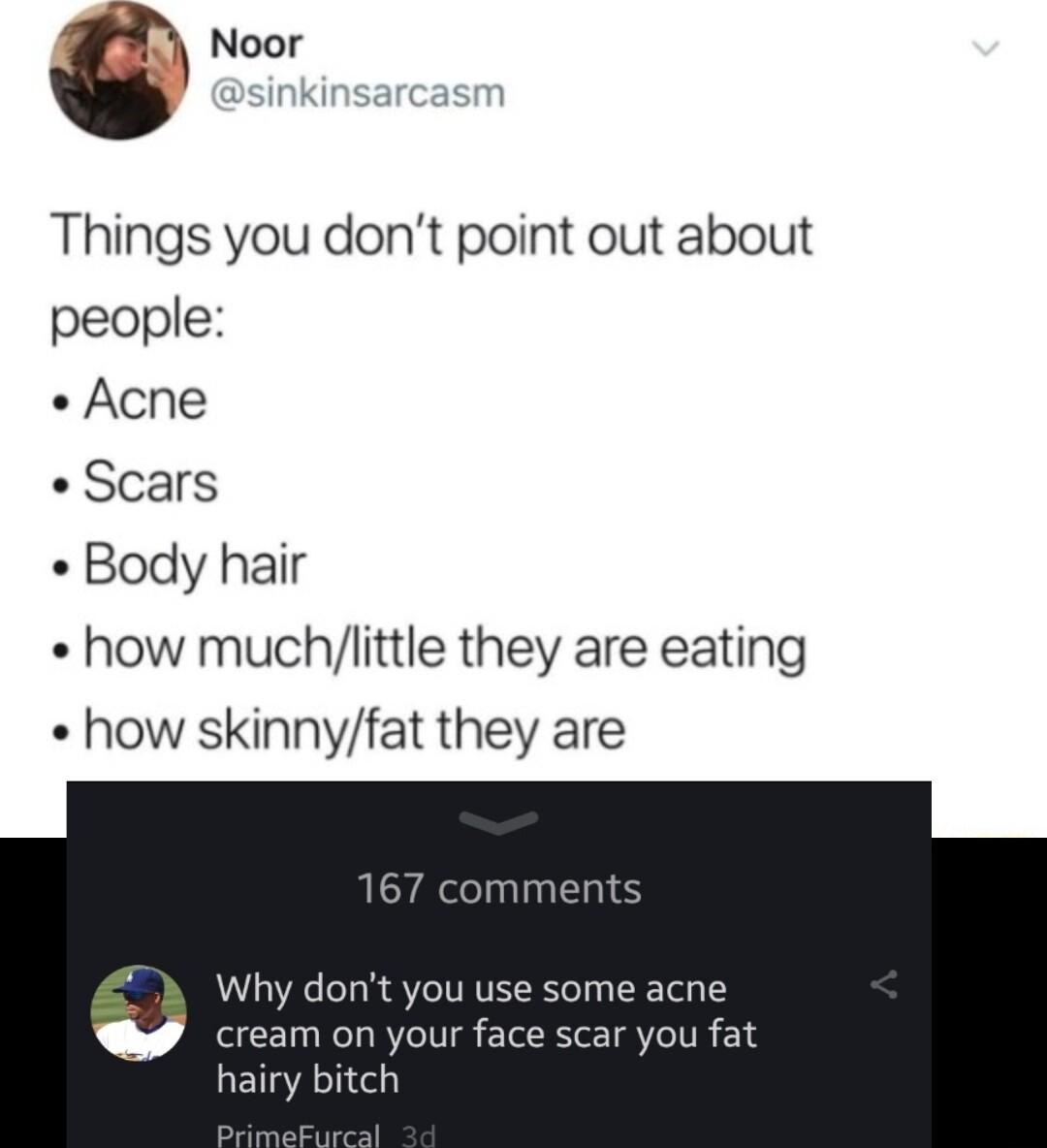 c Noor ink sm Things you dont point out about people Acne Scars Body hair how muchlittle they are eating how skinnyfat they are Why dont you use some acne am on your f you fat hairy bitch