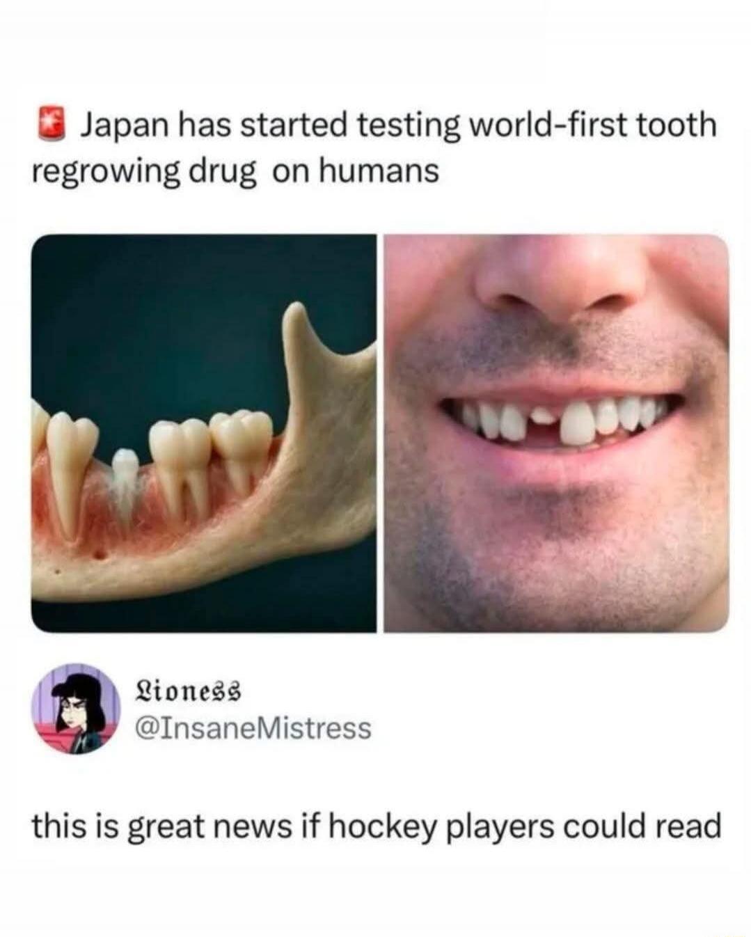 Japan has started testing world-first tooth regrowing drug on humans. Lioness @InsaneMistress. This is great news if hockey players could read.