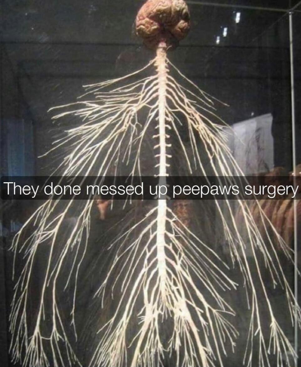 lessed UP peepaws surgery A