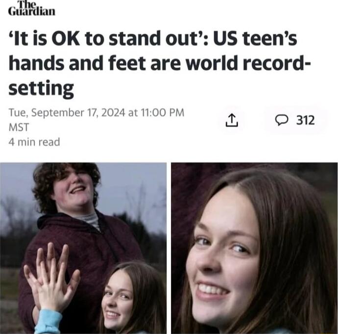 It is OK to stand out US teens hands and feet are world record setting mber 17 2024 at 1100 PM o 312
