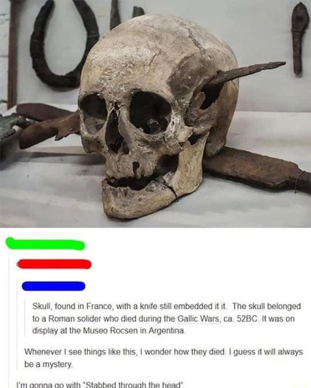 Skul found in France wit aknifo stil ombodded t it Th skull bolong ng the Galic Wars ca 52BC It 10a Roman solider who die as on display at the 1560 Rocsen in Argentina Whenever see things like his wonder how they died quess it wil always beamystery e amea e