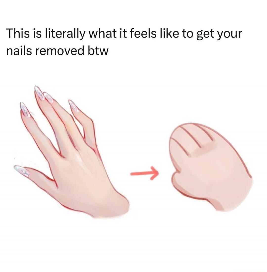 This is literally what it feels like to get your nails removed btw