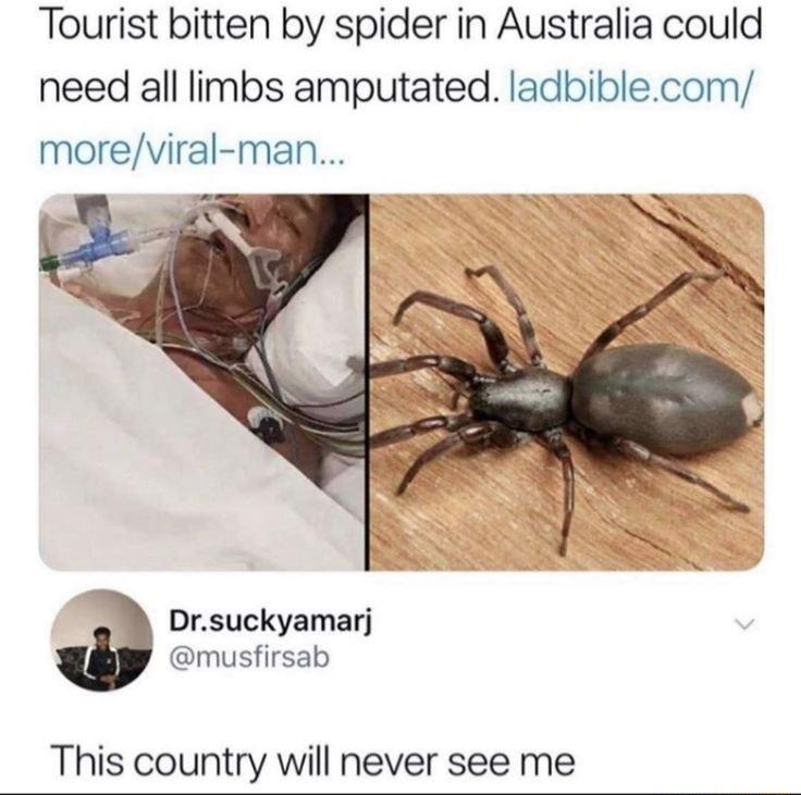 Tourist bitten by spider in Australia could need all limbs amputated ladbiblecom moreviral man Drsuckyamarj musfirsab This country will never see me