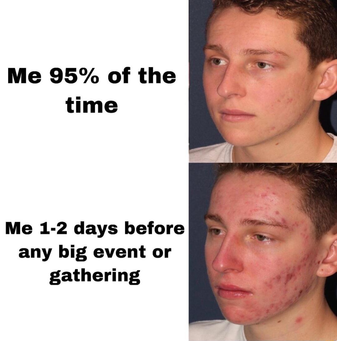 Me 95 of the time Me 1 2 days before any big event or gathering
