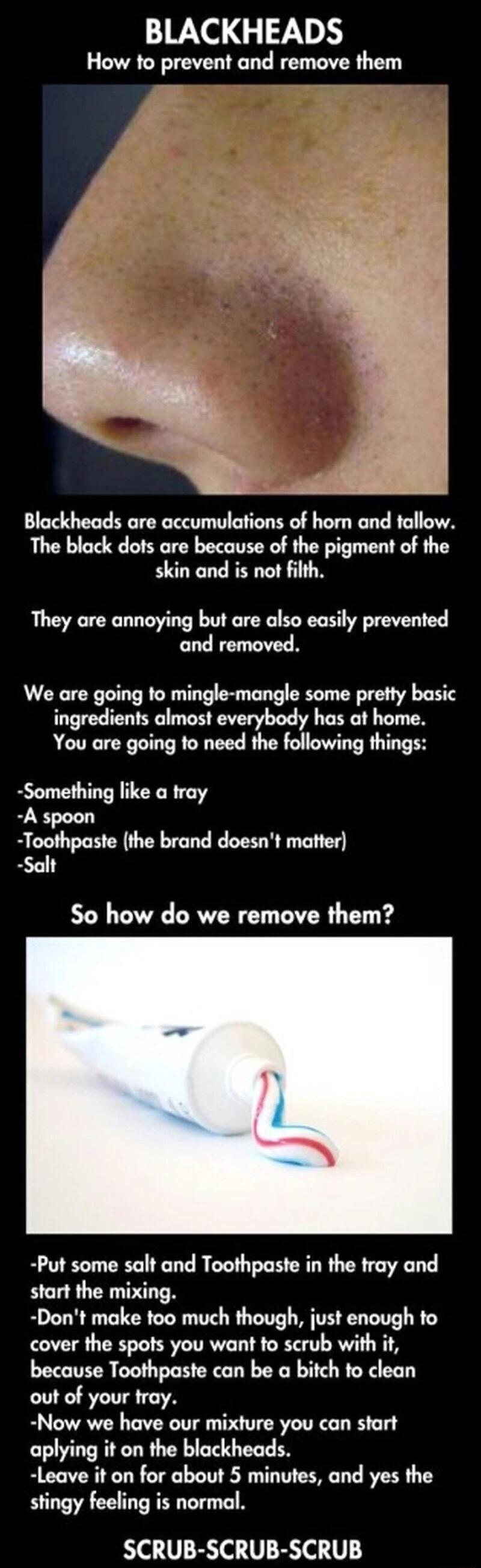 BLACKHEADS How to prevent and remove them Blackheads are accumulations of horn and tallow The black dots are because of the pigment of the skin and is not filth They are annoying but are also easily prevented and remor We are going to mingle mangle some pretty basic ingredients almost everybody has at home You are going fo need the following things Something like a tray A spoon Toothpaste the bran