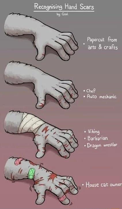Recognising Hand Scars Secogien T veotn Papercut from arts crafs Chef Auto mechanic