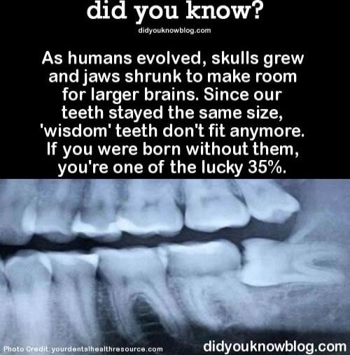 did you know IR As humans evolved skulls grew ELCNENER T IS Gy ELRGT for larger brains Since our LCE O ELRGEEET TRy SN wisdom teeth dont fit anymore If you were born without them youre one of the lucky 35 didyouknowblogcom