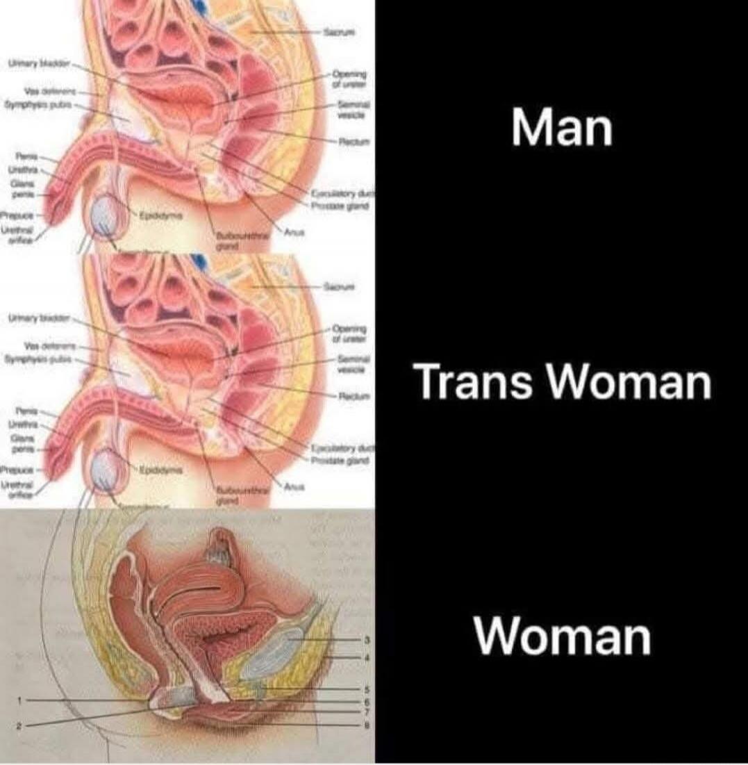 Man, Trans Woman, Woman. Diagrams showing male reproductive and urinary anatomy, including urinary bladder, sacrum, penis, urethra, glans penis, prepuce, urethral orifice, epididymis, bulbourethral gland, anus, opening of ureter, seminal vesicle, rectum, ejaculatory duct, prostate gland. Also a diagram showing female reproductive and urinary anatom