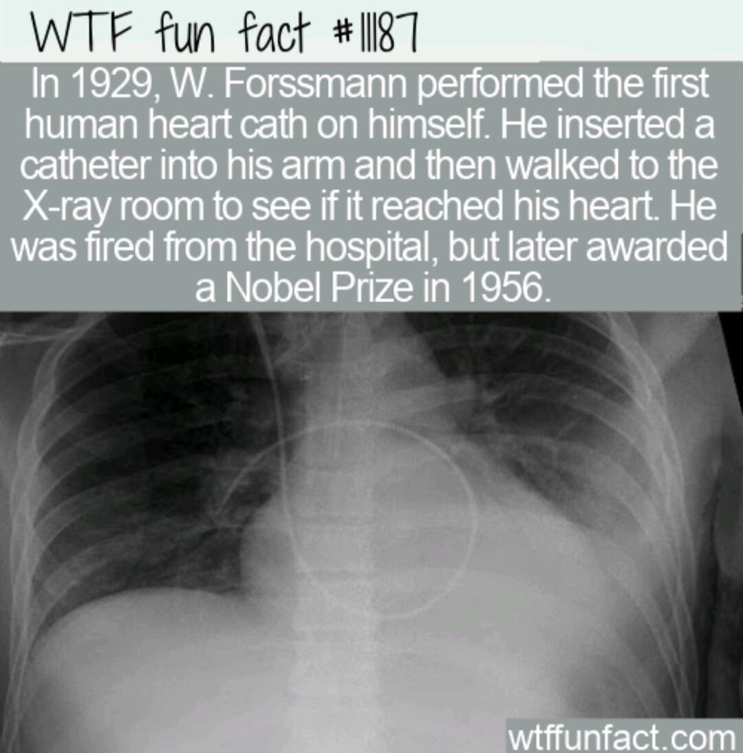 WTF fun fact II87