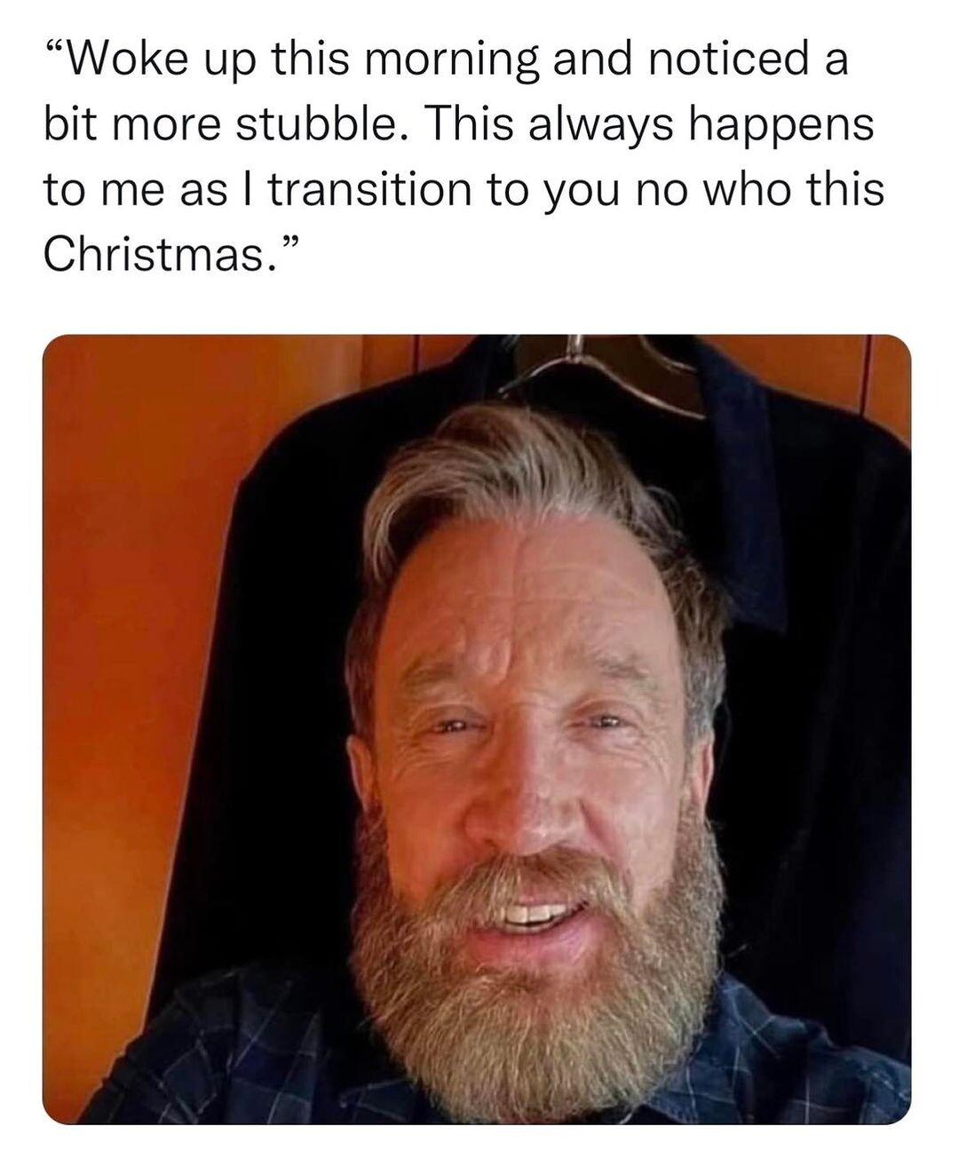 Woke up this morning and noticed a bit more stubble This always happens to me as transition to you no who this Christmas