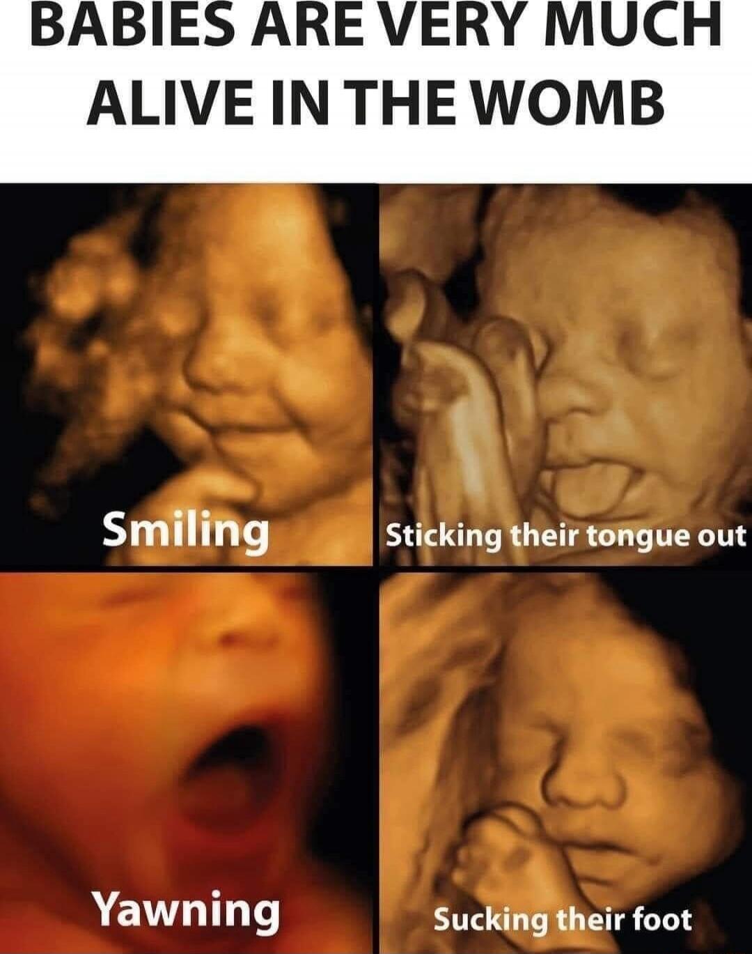 BABIES ARE VERY MUCH ALIVE IN THE WOMB
Smiling
Sticking their tongue out
Yawning
Sucking their foot