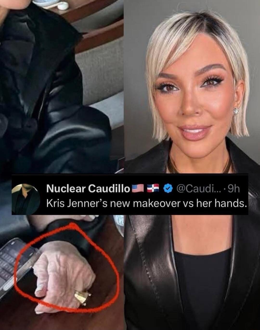Nuclear Caudillo: Kris Jenner's new makeover vs her hands.