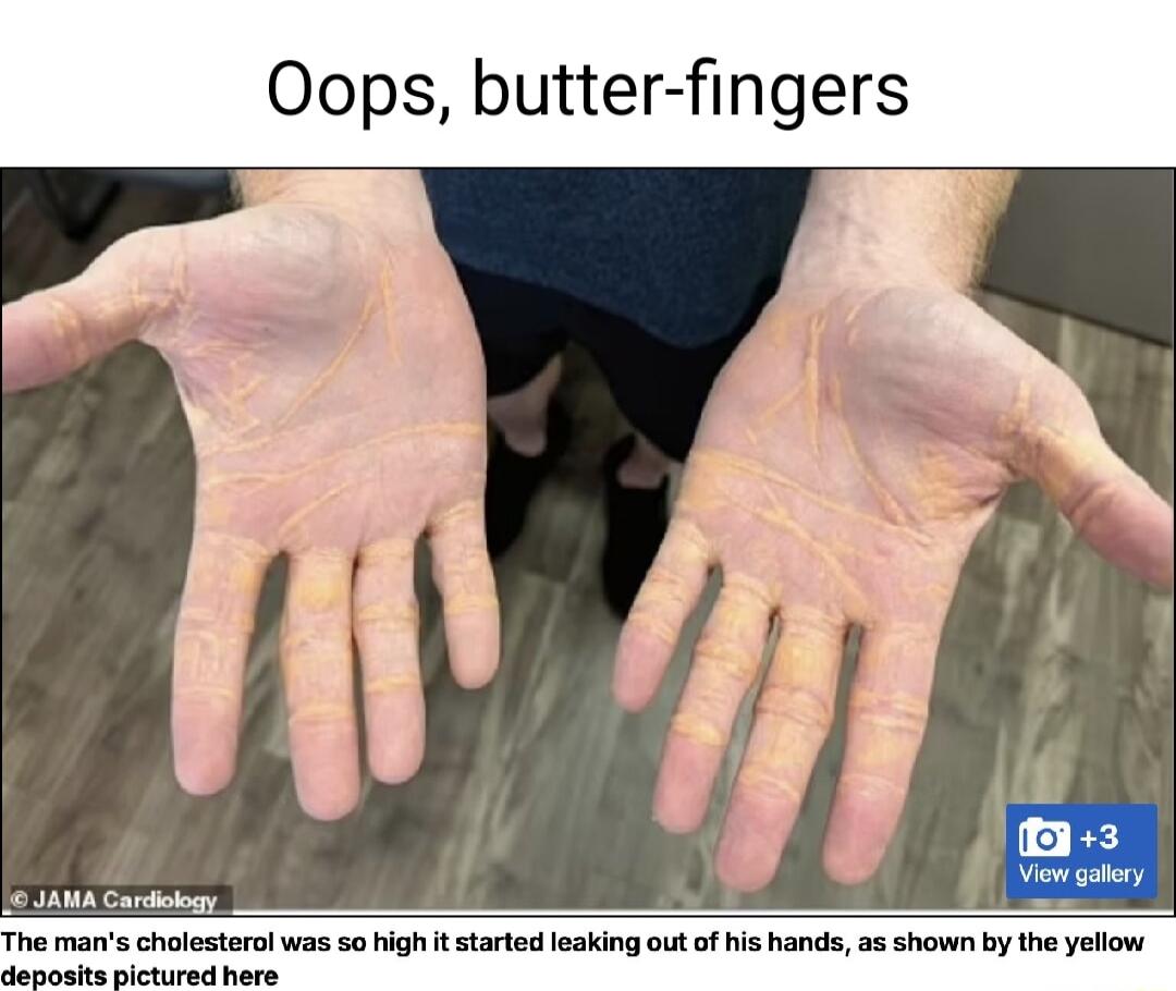 Oops butter fingers