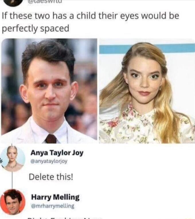 W Errrees If these two has a child their eyes would be perfectly spaced Anya Taylor Joy anyataylorjoy Delete this Harry Melling BBl omharymeling