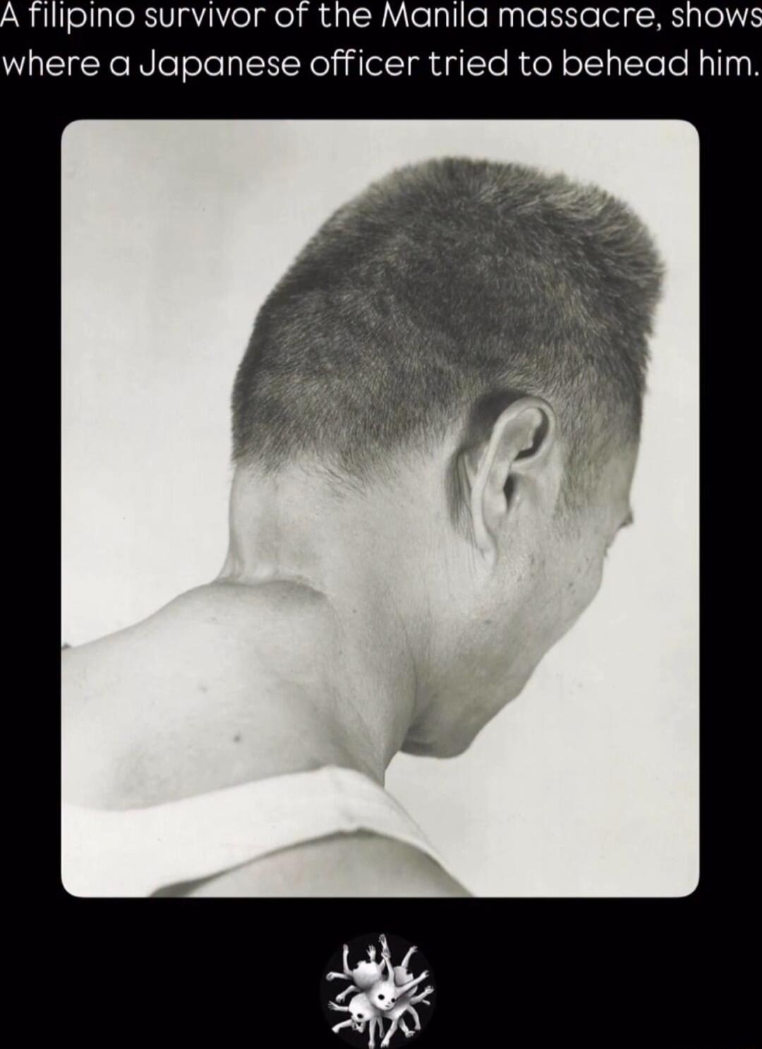 ipino survivor of the Manila massacre shows where a Japanese officer tried to behead him