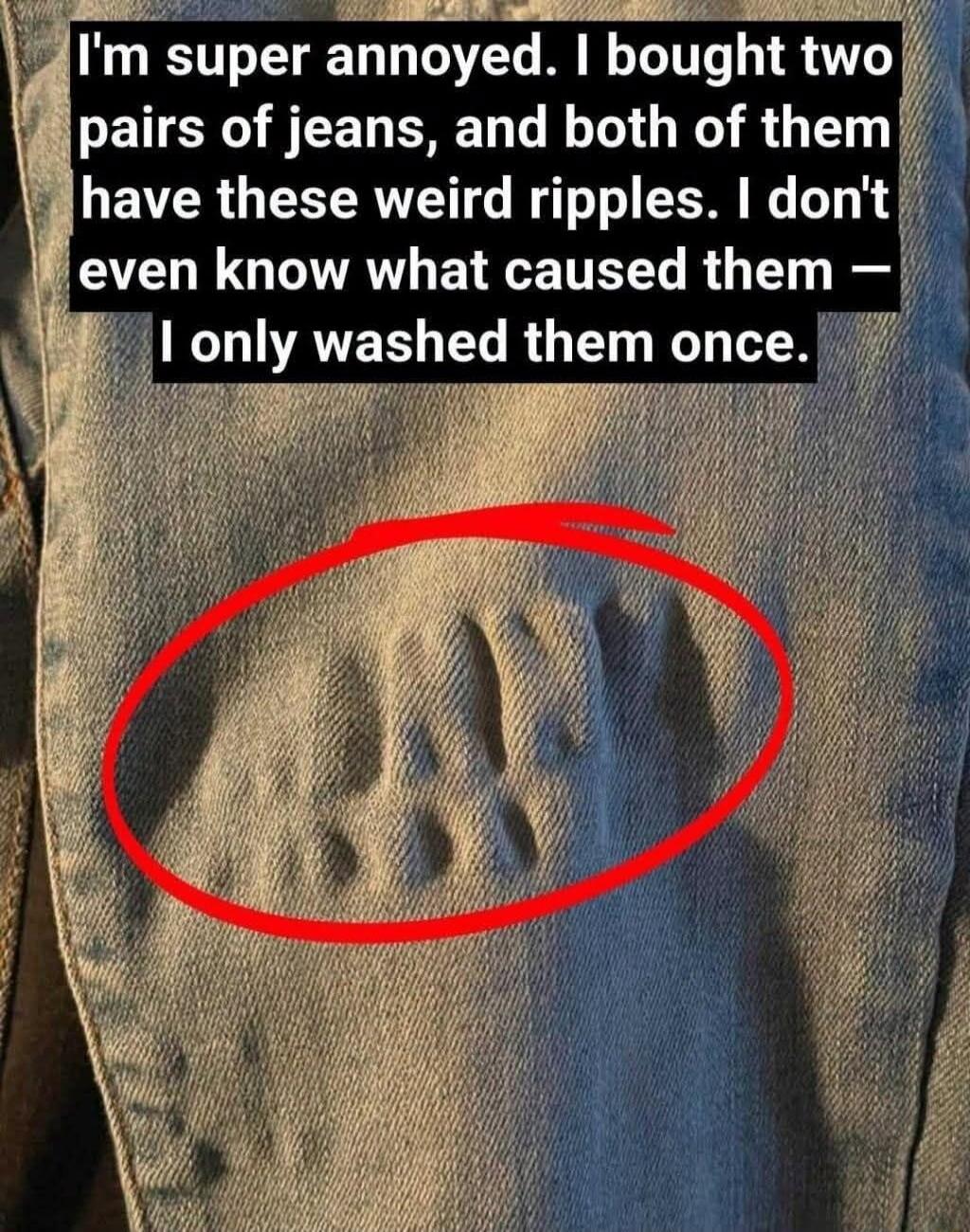 I'm super annoyed. I bought two pairs of jeans, and both of them have these weird ripples. I don't even know what caused them — I only washed them once. HELP!