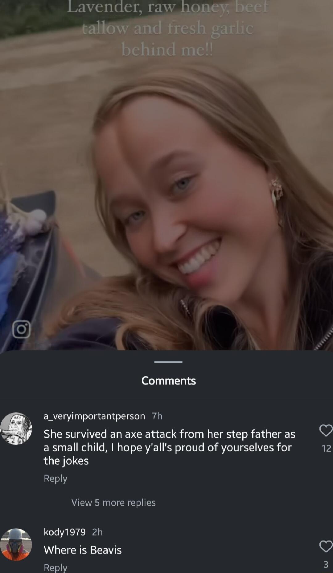 Comments a_veryimportantperson 7h Q She survived an axe attack from her step fatheras asmall child hope yalls proud of yourselves for 12 the jokes Reply View 5 more replies kody1979 2h Where is Beavis O Paply 3