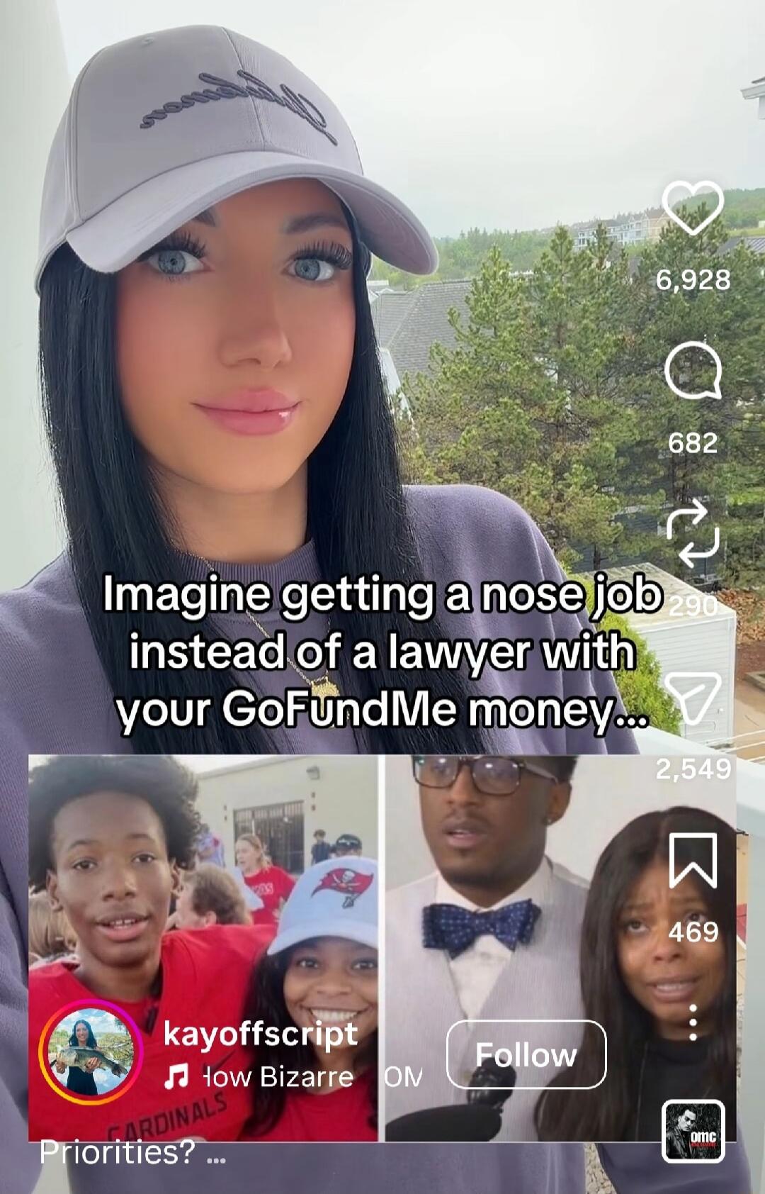 Imagine getting a nose job instead of a lawyer with your GoFundMe money... Priorities?