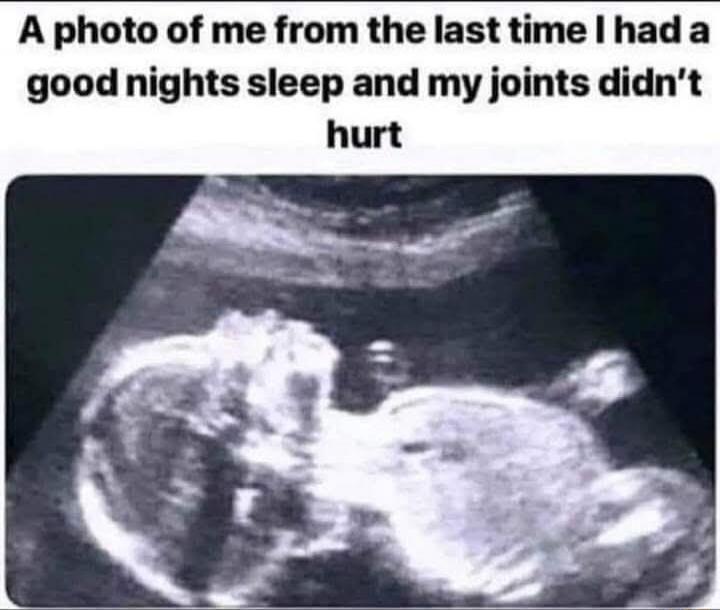A photo of me from the last time I had a good nights sleep and my joints didn’t hurt