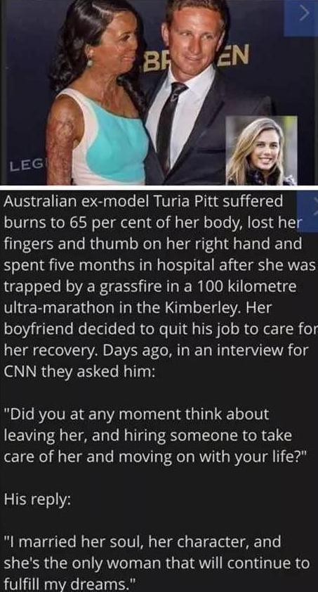Australian ex model Turia Pitt suffered burns to 65 per cent of her body lost her fingers and thumb on her right hand and spent five months in hospital after she was trapped by a grassfire in a 100 kilometre UlleRpETCIGIT R RGNl VA g 10 1aTe Ne lelle T RV X VIQl s I o SR e e R 0 her recovery Days ago in an interview for NRGEENEC R TNTE Did you at any moment think about leaving her and hiring someo