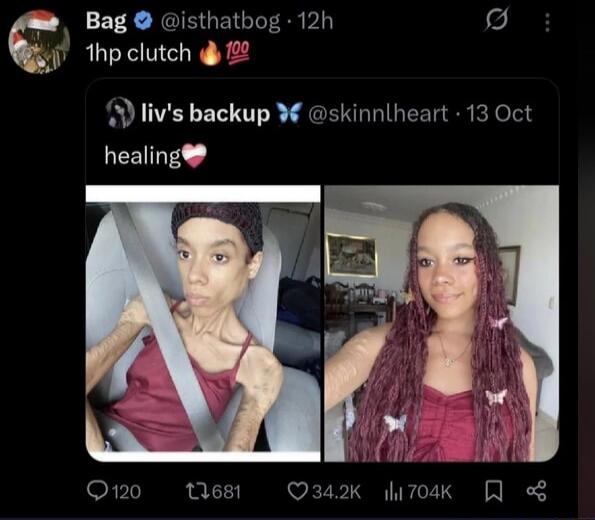 Bag @isthatbog 12h 1hp clutch 🔥💯
liv's backup @skinnlheart 13 Oct healing💖