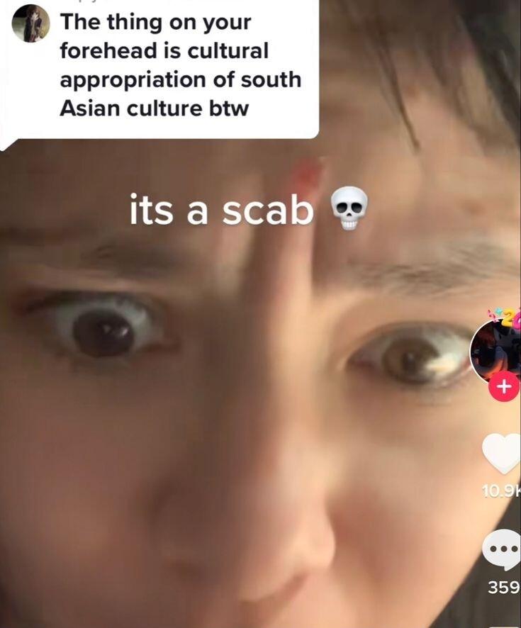 The thmg on your forehea cultural appropriation of south Asian culture btw its a scab ELE