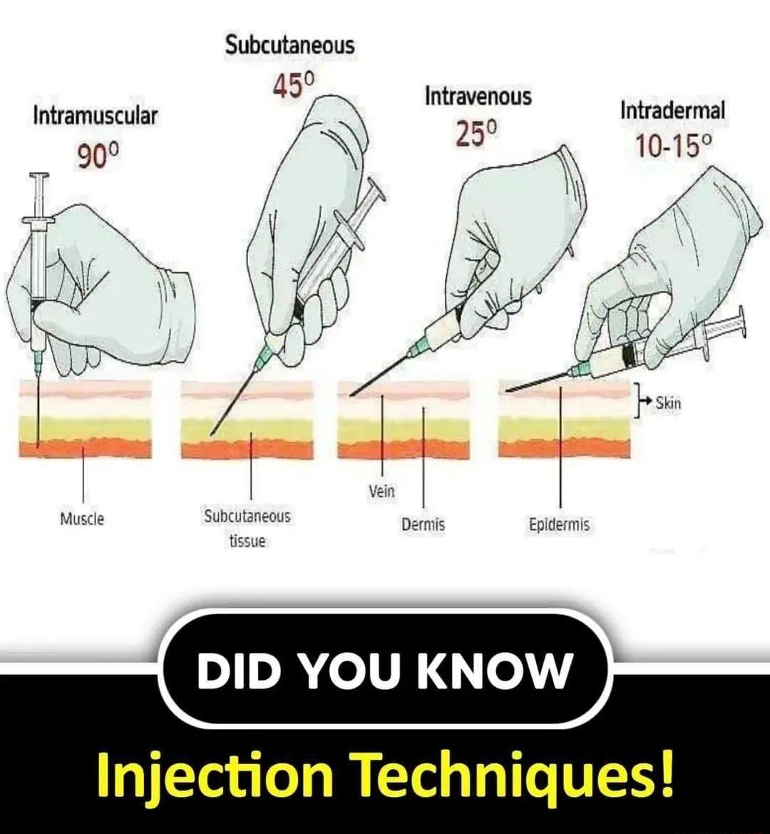 Subcutaneous 1 DID YOU KNOW F Injection Techniques